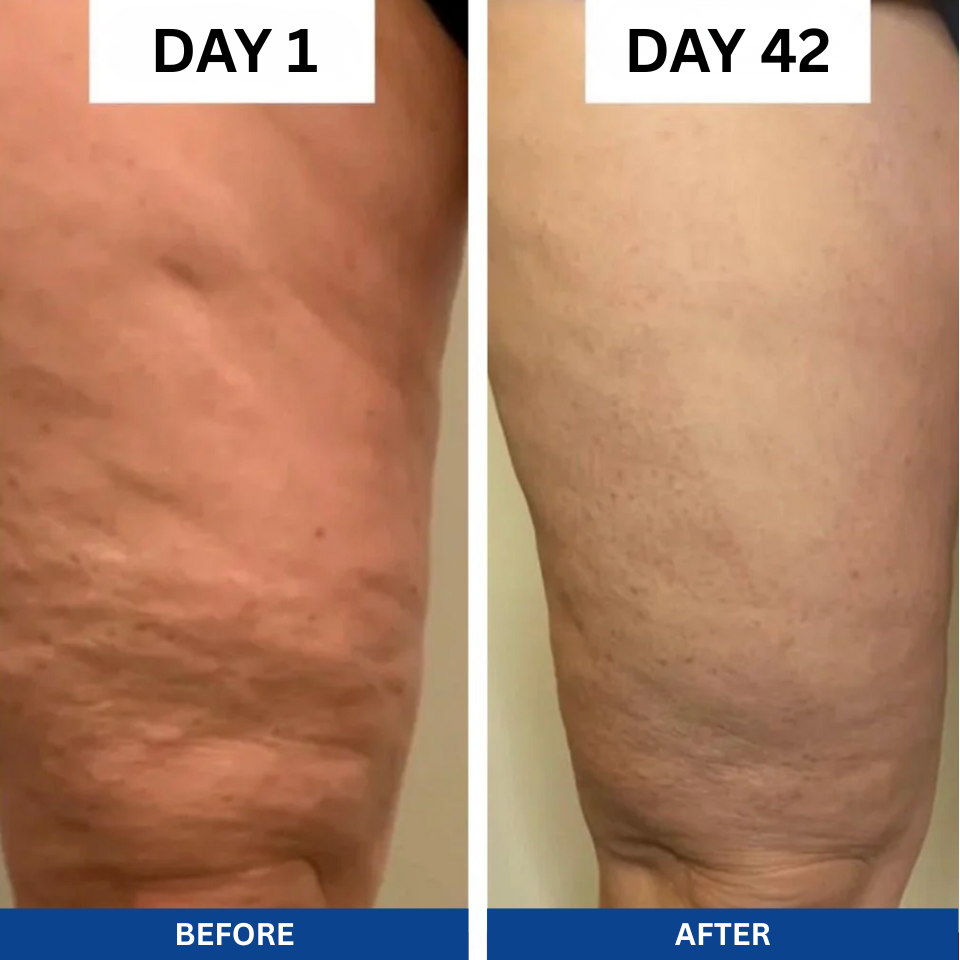 Anti-Cellulite Oil