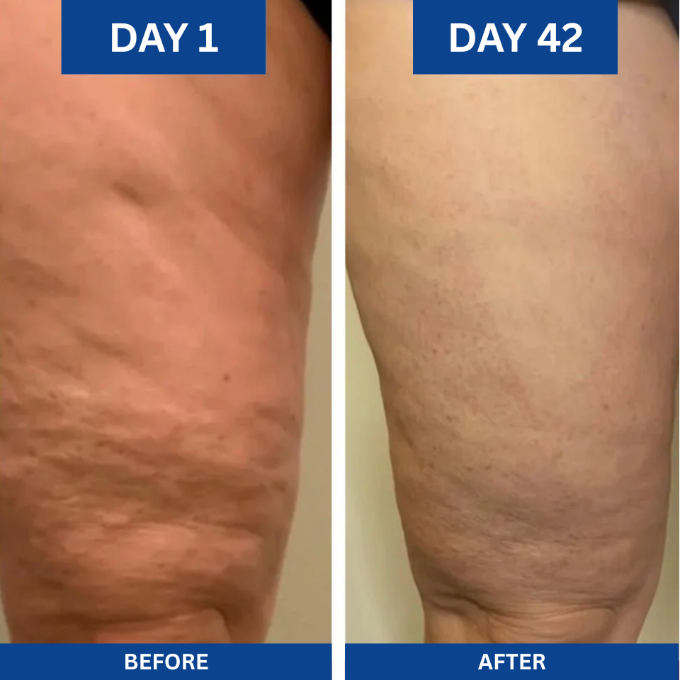 Anti-Cellulite Massage Oil