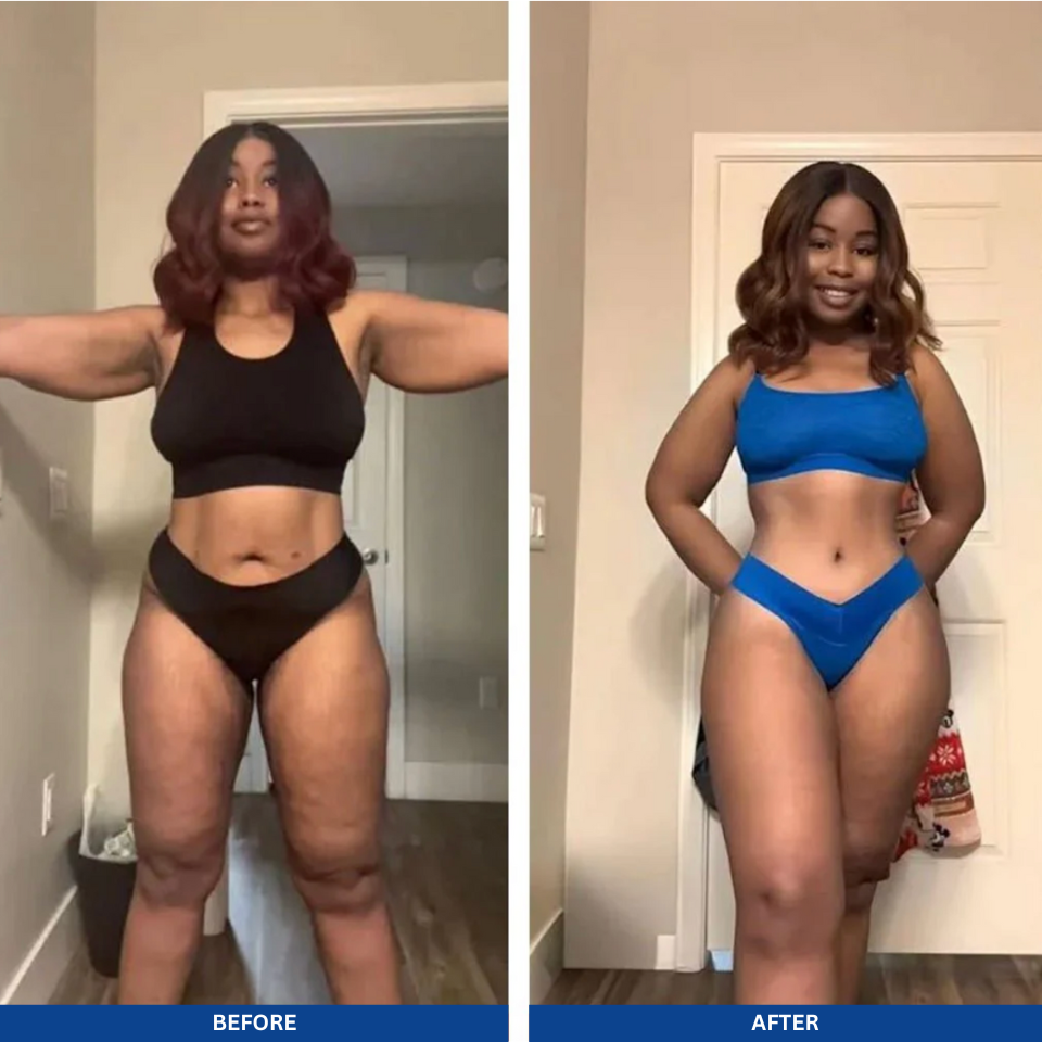 Anti-Cellulite Oil