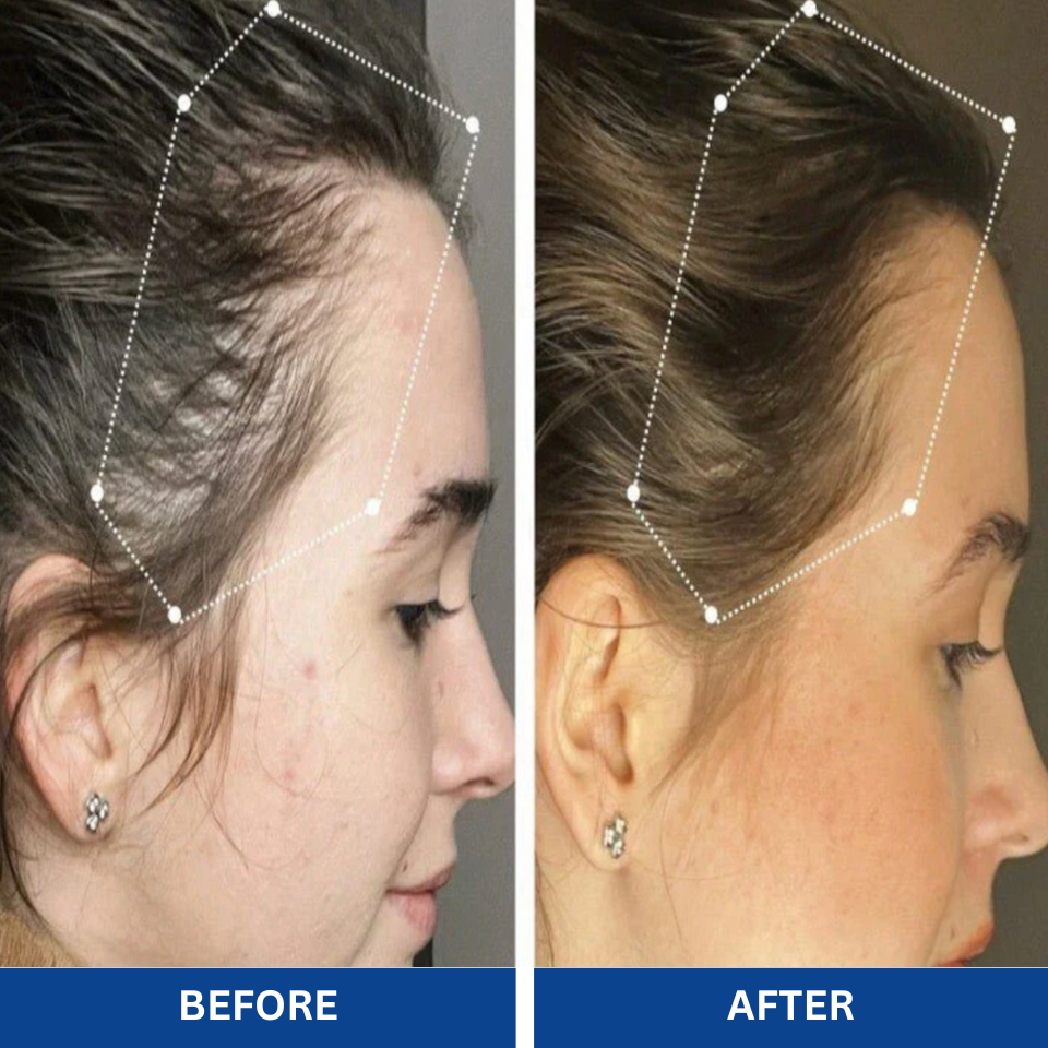 Advanced Hair Growth Roll-On Serum